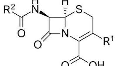 article