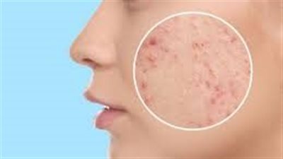 article