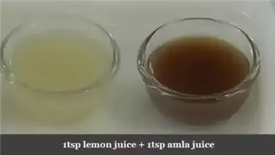 article