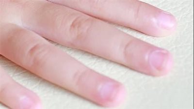 article